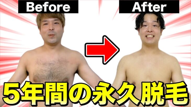 【全身脱毛】毛が濃い男が5年間永久脱毛に通った結果！！！【脱毛集大成Vlog】